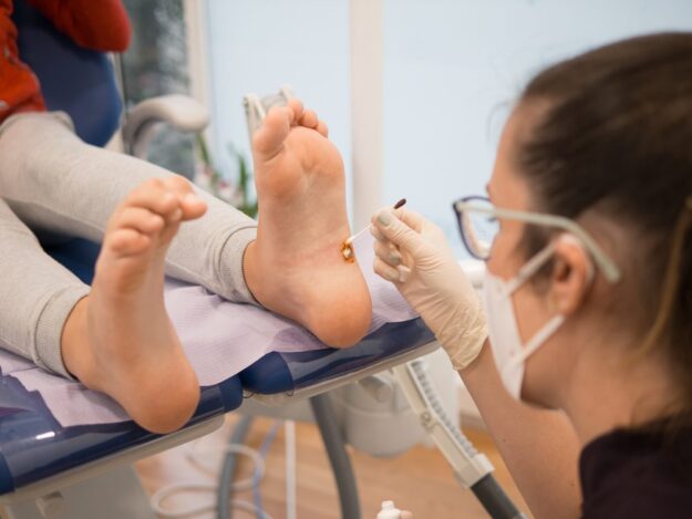 Exploring the Latest Treatments for Plantar Warts