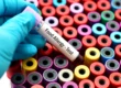 Navigating the Process of Allergy Testing