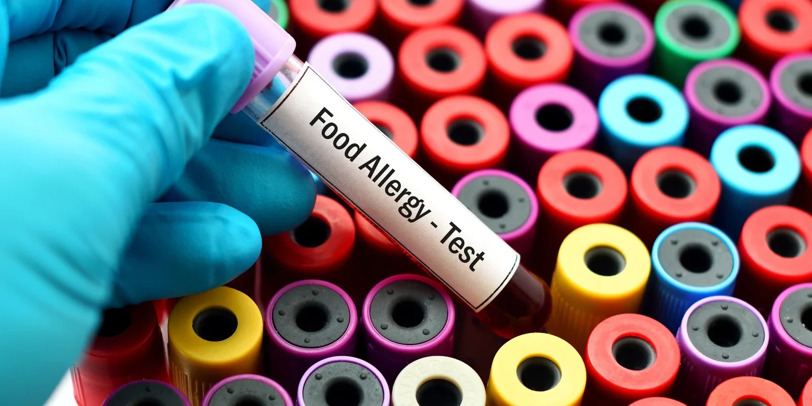 Navigating the Process of Allergy Testing