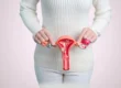 Symptoms, Diagnosis, and Treatment of Fibroids