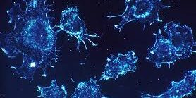 Types of Cancer That an Oncologist Will Treat