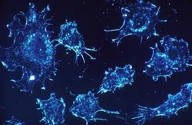 Types of Cancer That an Oncologist Will Treat