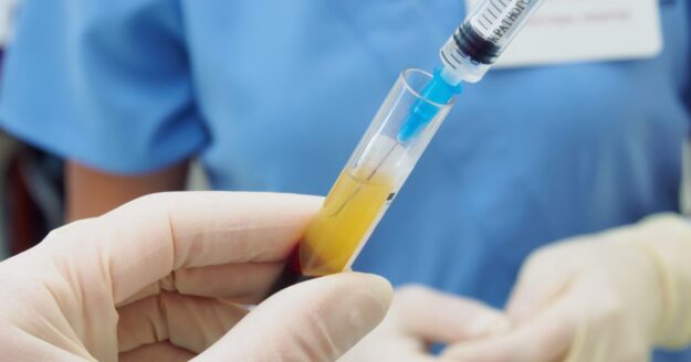Using PRP for Sports Injuries