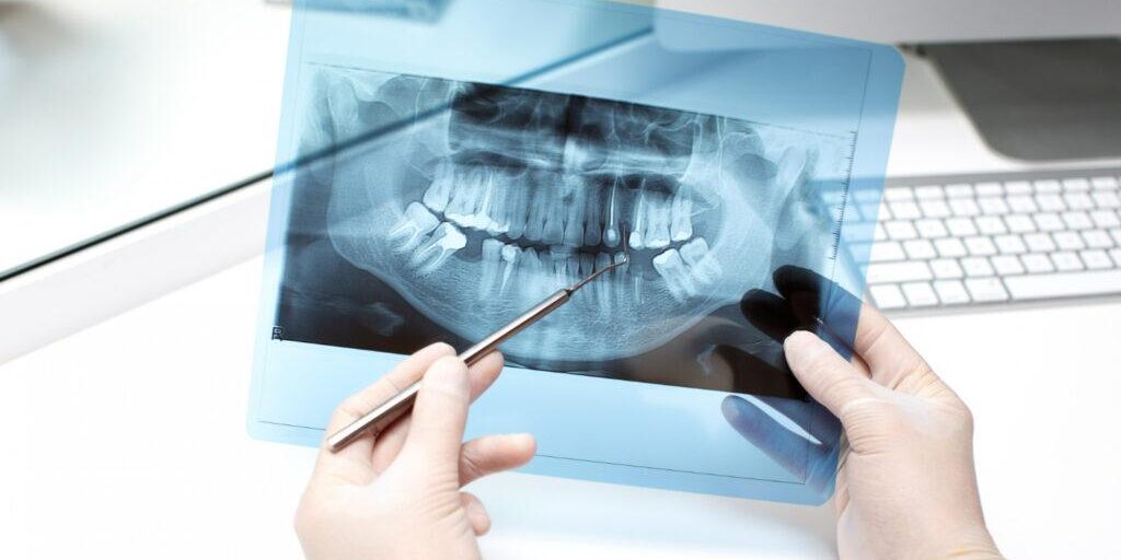 What Patients Should Know Before Their X-Ray Appointment