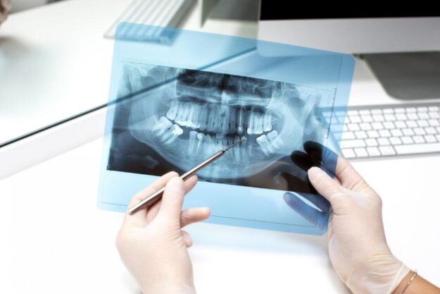 What Patients Should Know Before Their X-Ray Appointment