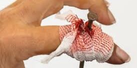 4 Tips for Wound Care 4 Tips for Wound Care