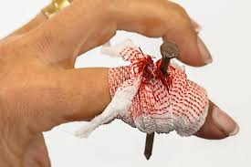 4 Tips for Wound Care