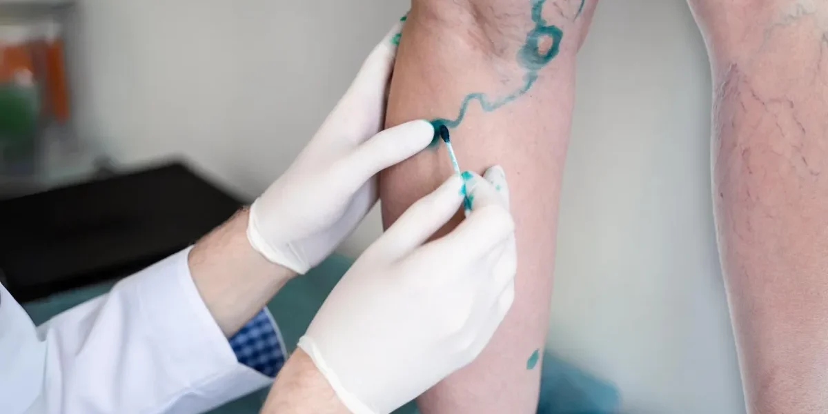 How To Maximize Your Experience at a Vein Clinic