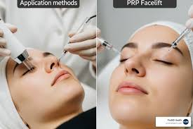 The Science Behind PRP Therapy and Its Applications in Medicine