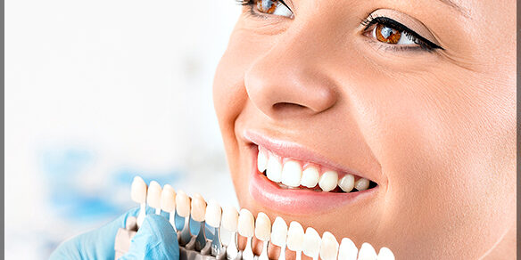 What You Need To Know About Teeth Whitening Safety What You Need To Know About Teeth Whitening Safety