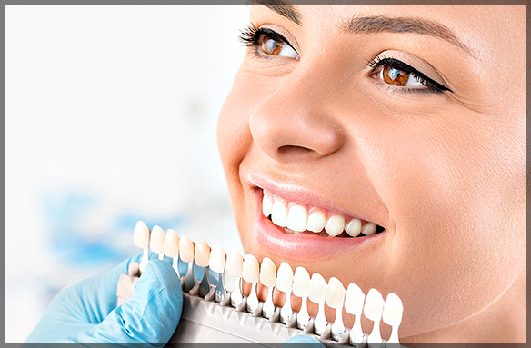 What You Need To Know About Teeth Whitening Safety