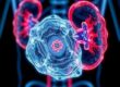 Innovative Treatments in Urology