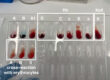 Understanding Different Types of Lab Tests and Their Purposes