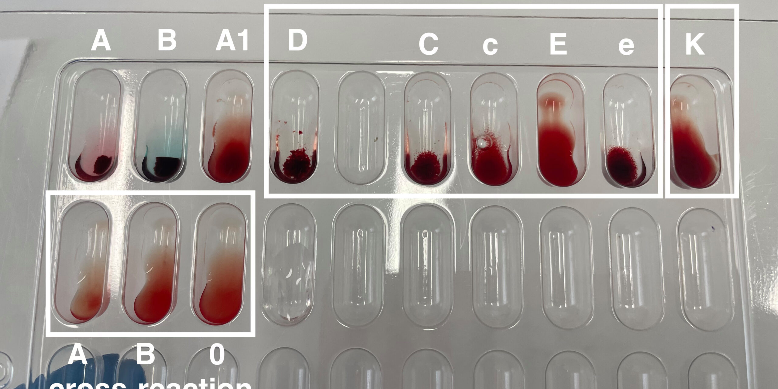 Understanding Different Types of Lab Tests and Their Purposes Understanding Different Types of Lab Tests and Their Purposes