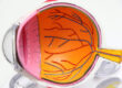 3 Signs You Need an Eye Exam