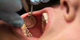 How To Spot Cracked Teeth Early for Effective Treatment How To Spot Cracked Teeth Early for Effective Treatment