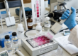 The Role of Regular Cholesterol Screening