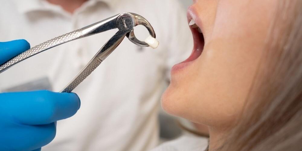 Understanding the Different Types of Cosmetic Dentistry Procedures Understanding the Different Types of Cosmetic Dentistry Procedures