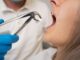 Understanding the Different Types of Cosmetic Dentistry Procedures